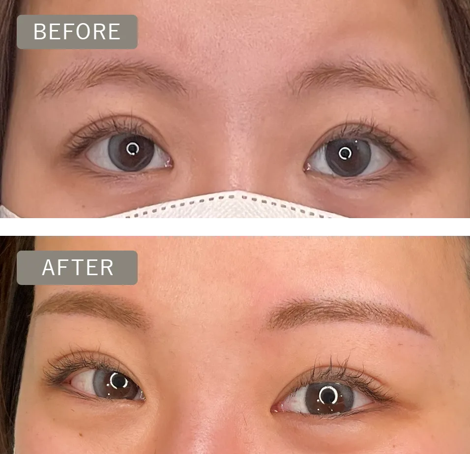 眉のbeforeとafterの写真